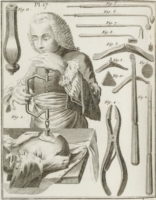 DIDEROT, Denis (1713-1784) and Jean D'ALEMBERT (1717?-1783), editors. Encyclopédie ou dictionnaire raisonné des sciences, des arts et des métiers par une société des gens des lettres. Geneva: Pellet, 1777-79; Neuchâtel: La Société Typographique, 1779 (vol. 30 only). - Receuil de planches pour la nouvelle édition du dictionnaire raisonné des sciences, des arts et des métiers. Geneva: Pellet, 1778-1779.