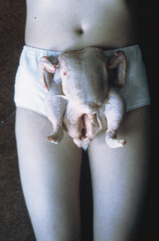 Sarah Lucas (B. 1962)
