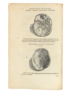 ANDREAS VESALIUS (1514-1564)